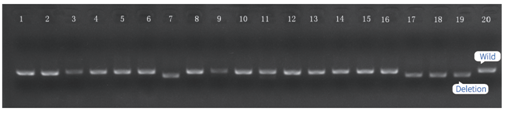 CRISPRCas9 基因编辑筛选阳性克隆电泳图