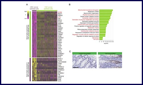 GUT 高分文章‖基因组测序 + 单细胞测序应用于发病机制研究