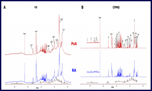代谢组 | 利用代谢物和脂质类差异来鉴定 negRA 和 PsA 潜在生物标志物