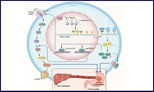 IF>10│常见肿瘤 RNA m6A 修饰研究的发文套路解析