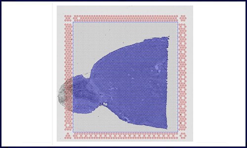 空间转录组 | 专业的 10x 空间转录组 summary 网页报告解读