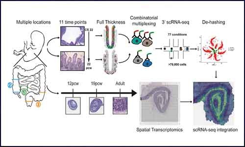 强强联手 | 单细胞测序 & 空间转录组测序揭示肠道发育