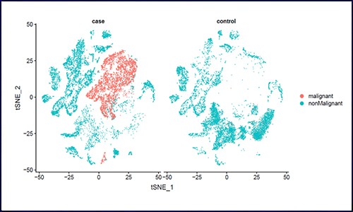 生信分析 | 个性化分析之恶性肿瘤分析