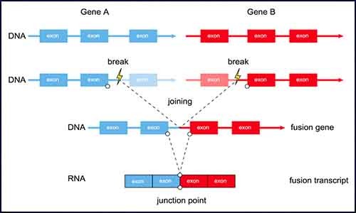肿瘤基因组融合基因检测技术揭示癌症的真相