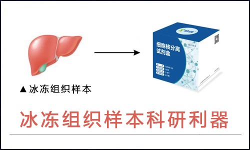 师兄又发文章了，我看着手里的冰冻组织很着急！