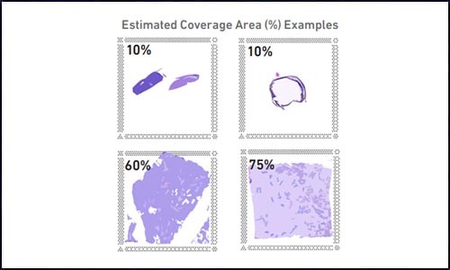 空间转录组测序 | 实验踩坑心得