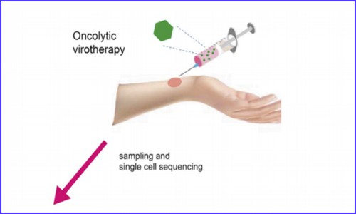 文献解读 | 应用单细胞测序技术研究溶瘤病毒的治疗作用机制
