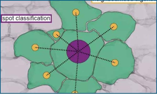 空间转录组联合单细胞 RNA 测序技术 | 揭示对胰岛素有明显敏感性的人类脂肪细胞亚群