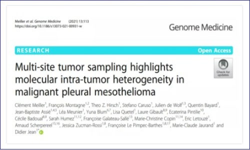 多组学文献解析丨多组学揭示恶性胸膜间皮瘤异质性