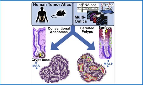 Cell 发表结直肠癌前病变多组学图谱，揭示两种常见结直肠息肉的不同癌变路径