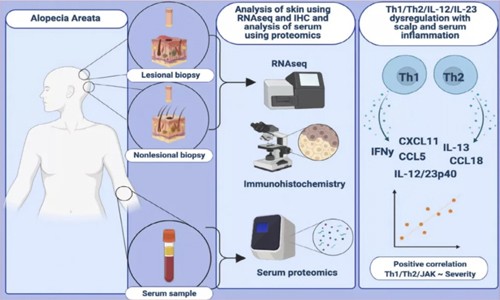 Olink 科研文献 | 血清标志物为实现斑秃无创诊断和靶向治疗提供新希望