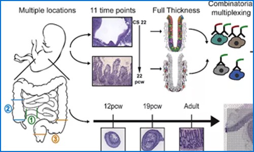 多组学联合 | 单细胞测序联合空间转录组绘制人类肠道时空发育图谱