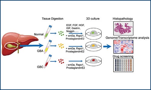 项目文章 | 金沙9001cc以诚为本单细胞测序分析助力类器官胆囊癌建模和药物筛选