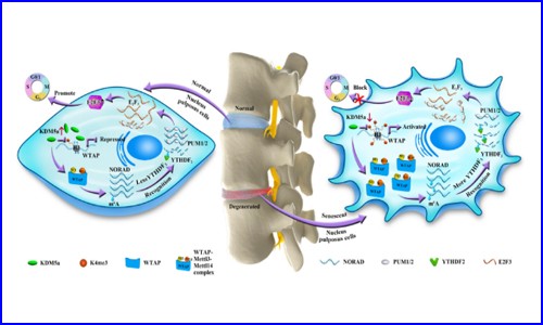 文献解读 |WTAP 介导的 lncRNA NORAD 的 m6A 修饰促进椎间盘退变（IVDD）