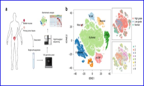 文献解读 | 单细胞测序研究膀胱癌中癌症相关成纤维细胞