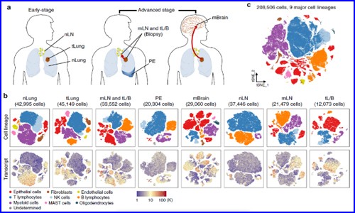 文献解读 | 单细胞测序技术，揭示转移性肺腺癌的单细胞转录组图谱