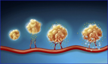 文章解析 |Cell 首次大规模高分辨率揭示从一个携带致癌突变的单细胞演变为侵袭性肿瘤的全过程