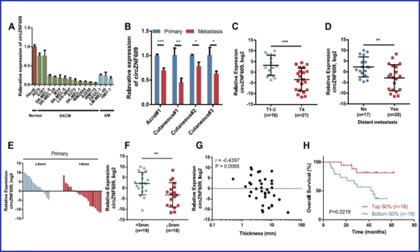 项目文章 | 金沙9001cc以诚为本 circRNA 测序助力在肢端和皮肤黑色素瘤的转移中发挥重要作用的调控因子 --circZNF609