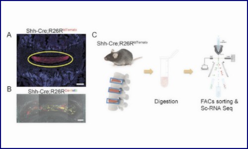文献解读 | 鉴定和应用髓核前体细胞治疗椎间盘退变