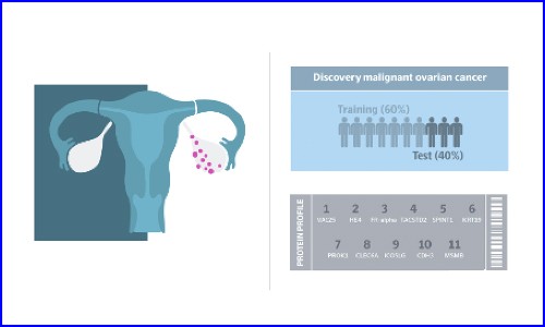文献解读 | 运用 Olink 蛋白质组发现生物标志物组合加速卵巢癌无创早诊