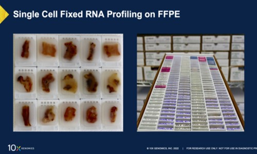 全方位解锁 FFPE 样本 |10x Genomics 单细胞 + 空间解决方案全方位解锁 FFPE 样本中蕴含的宝贵信息