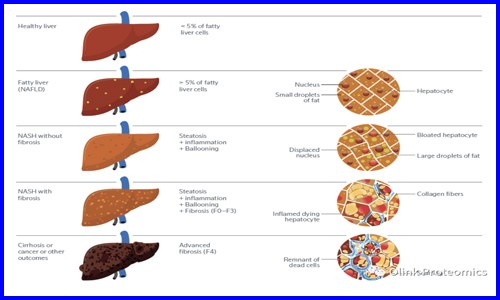 Nat Gen 干货 |deCODE genetics 团队借助 Olink Explore 对 NAFLD 患者进行多组学研究