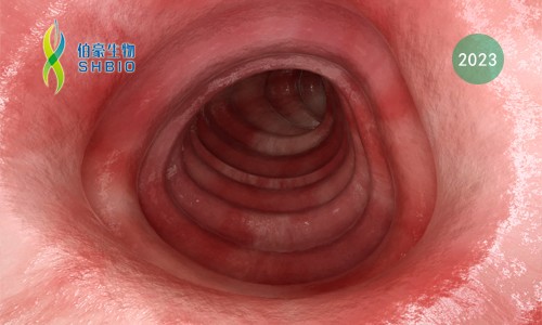文献解读 | 溃疡性结肠炎患者回肠 - 肛管袋免疫细胞的单细胞转录研究