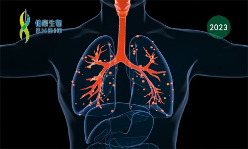 项目文章 | 张鹏 / 王晨飞合作揭示非小细胞肺癌的微环境在免疫治疗中的动态变化