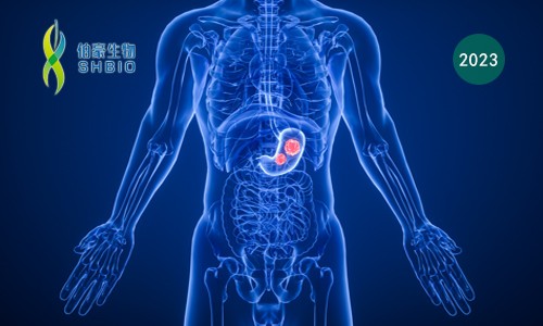 Cell 子刊 | 基于单细胞转录组测序数据，揭示胃腺癌进展过程中免疫、基质细胞状态及生态型演变