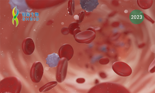 mRNA-seq 项目文章 | 棕榈酰转移酶 ZDHHC21 调节氧化磷酸化诱导 AML 分化阻滞和干性