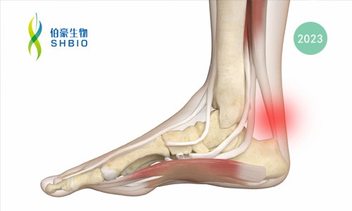 mRNA-seq 项目文章 | 高拉伸聚酯基压电弹性体同时实现跟腱断裂加速再生和运动监测