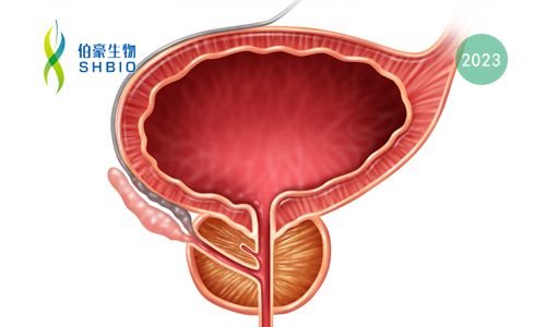 文献解读 | 在肺癌和前列腺癌中，通过下调 SOX2 抑制 Exportin 1 从而抑制神经内分泌转化