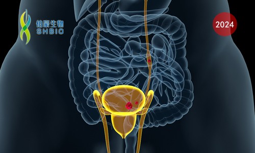 Nat Med 临床 II 期案例 |Olink 蛋白组学助力膀胱癌患者分层以推进精准诊疗