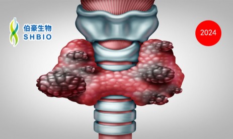 文献解读 | 甲状腺癌去分化的综合分析