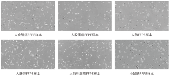 FFPE样本细胞核镜检图