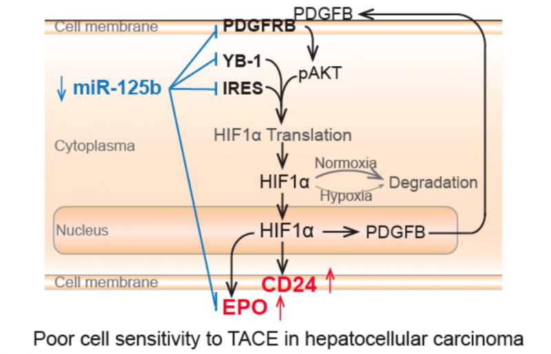 miR-125b 调节 HCC 细胞对 TACE 治疗的敏感性机制 
