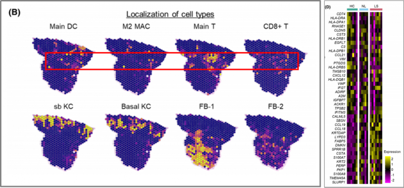 空间转录组测序 + 单细胞测序 + 蛋白组学测序 SCI 文章图 1